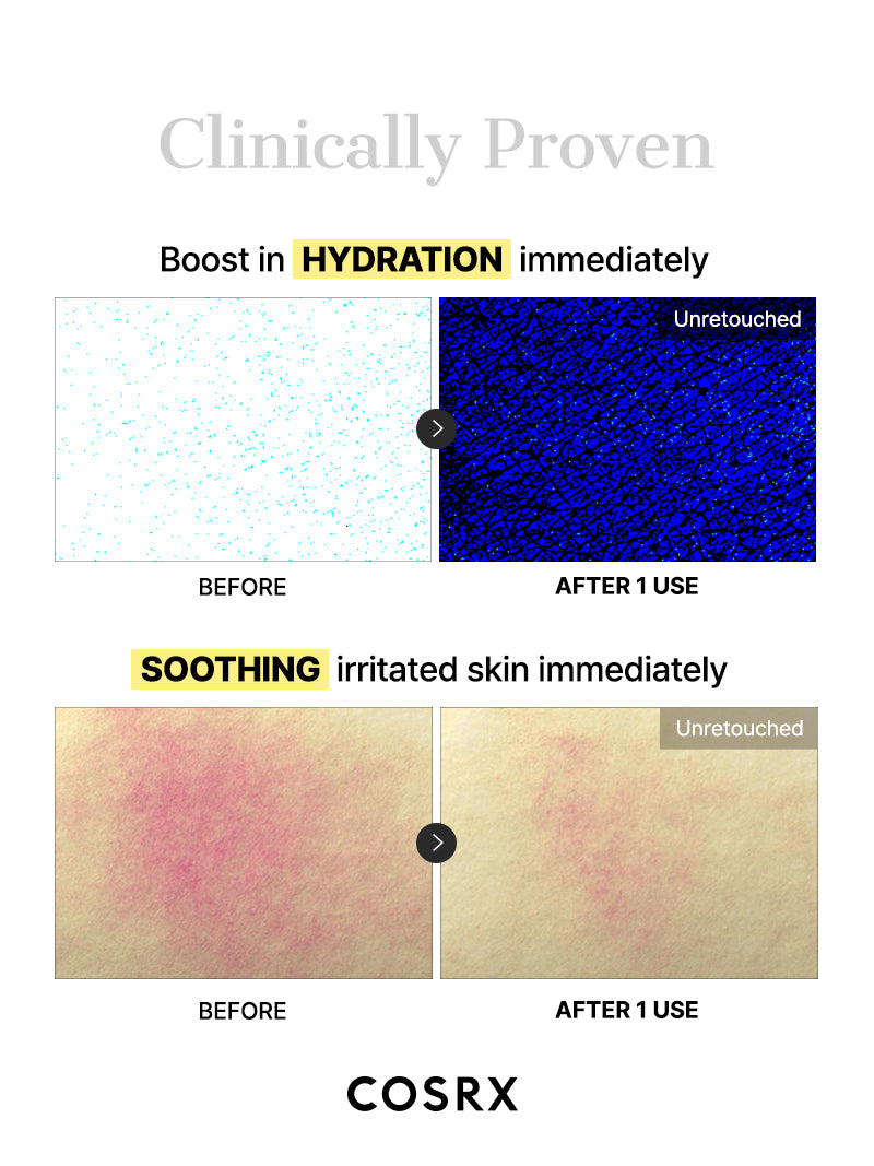 Advanced Snail Mucin Glass Glow Hydrogel Mask_3ea - Image 7